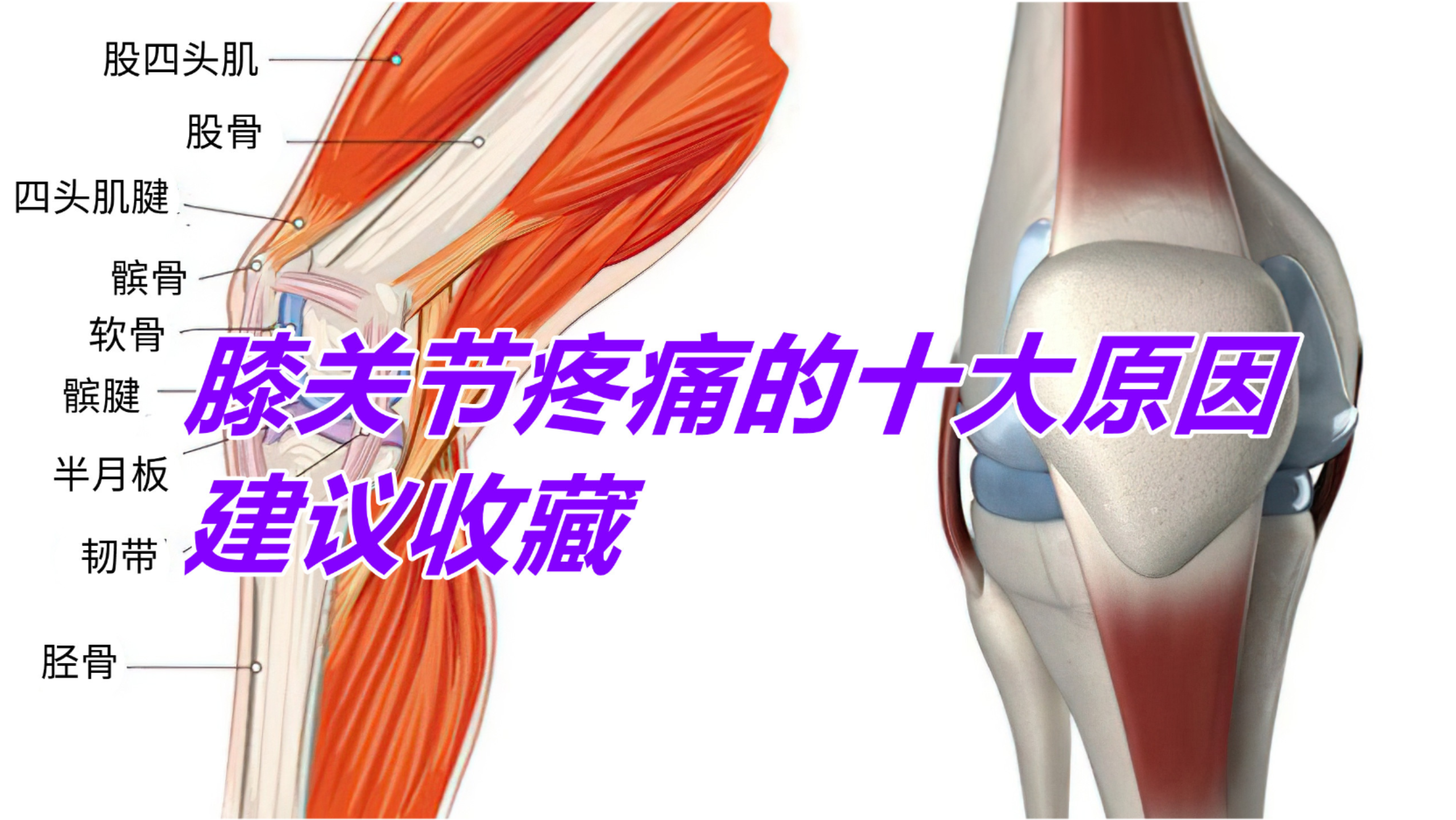 膝关节退行性关节炎