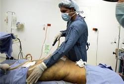 美媒体评出十大反自然犯罪吸脂减肥居首