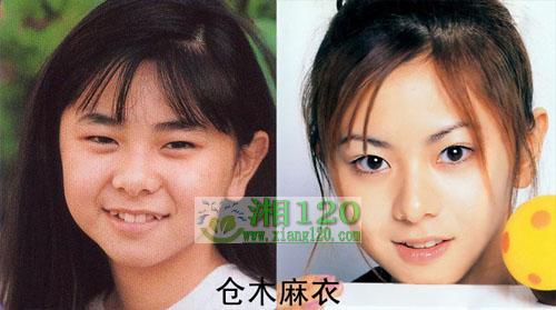 17位日本明星整容前后照片