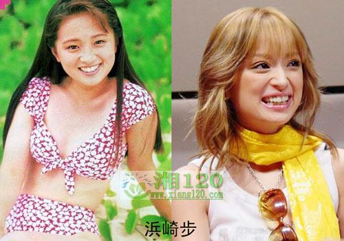 17位日本明星整容前后照片