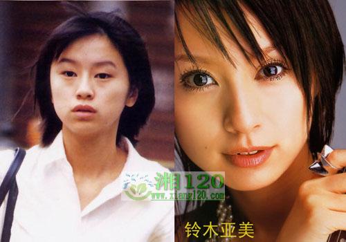 17位日本明星整容前后照片