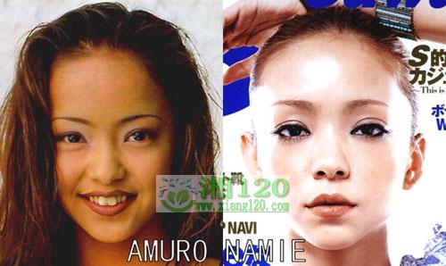 17位日本明星整容前后照片