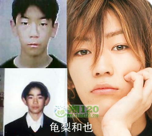 17位日本明星整容前后照片