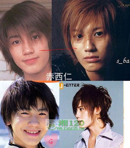 17位日本明星整容前后照片