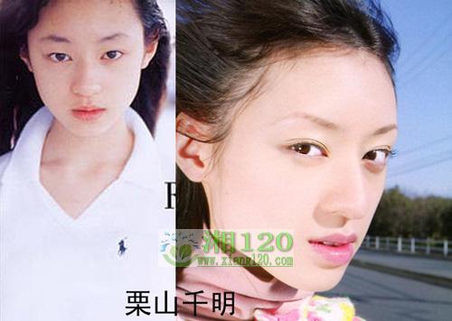 17位日本明星整容前后照片