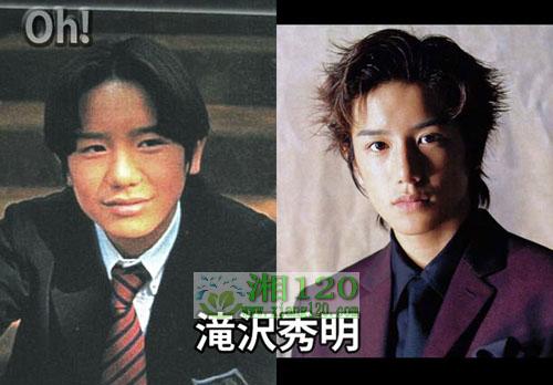 17位日本明星整容前后照片