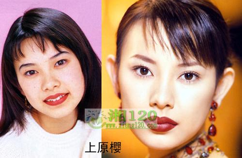 17位日本明星整容前后照片