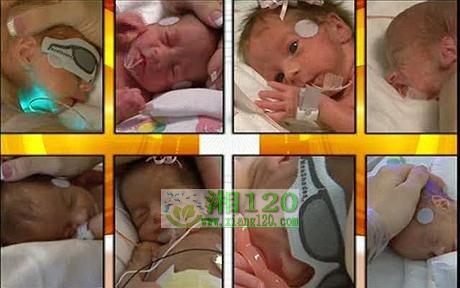 史上第二宗八胞胎亮相:相貌可爱但很瘦小