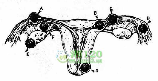 ��λ����