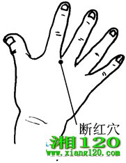 ͼ15-1ϺѨȡѨͼ