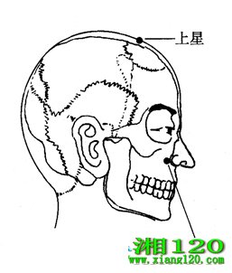 ͼ7-4-1ǡӭ