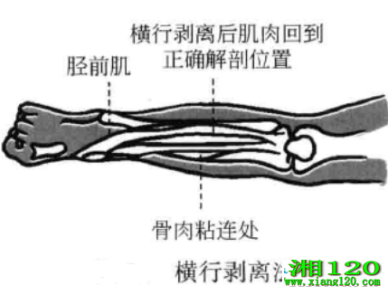 а뷨