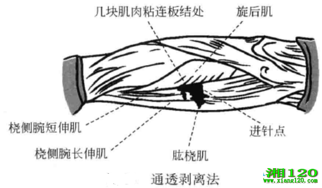 ͨ͸뷨