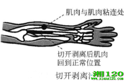 п뷨
