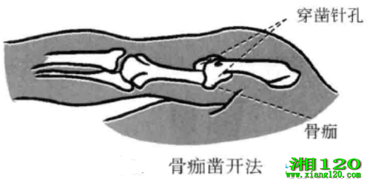 俪