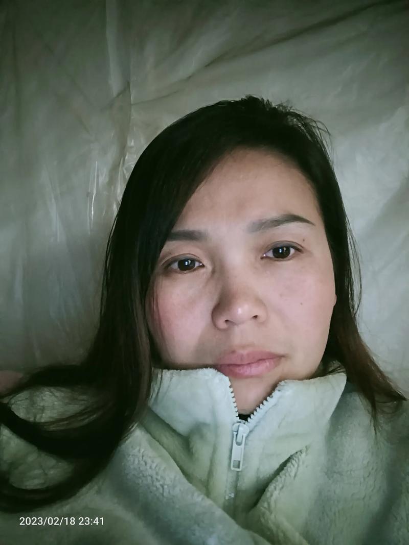 眼皮肿了是怎么回事 眼皮肿了是怎么回事