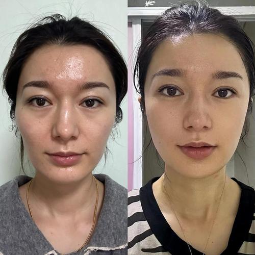 ��������ˮ�ȵ����Ч