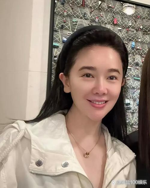 先天性斜颈能治好吗 先天性斜颈能治好吗