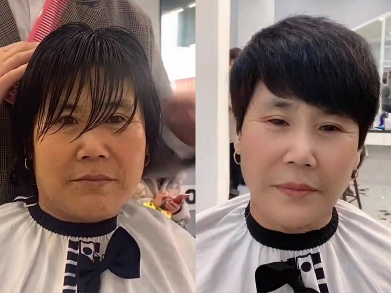 致密性髂骨炎很严重吗 致密性髂骨炎很严重吗