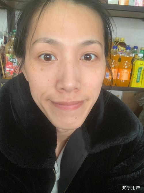 ����֬����Ǯһƿ ����֬����ʲô����