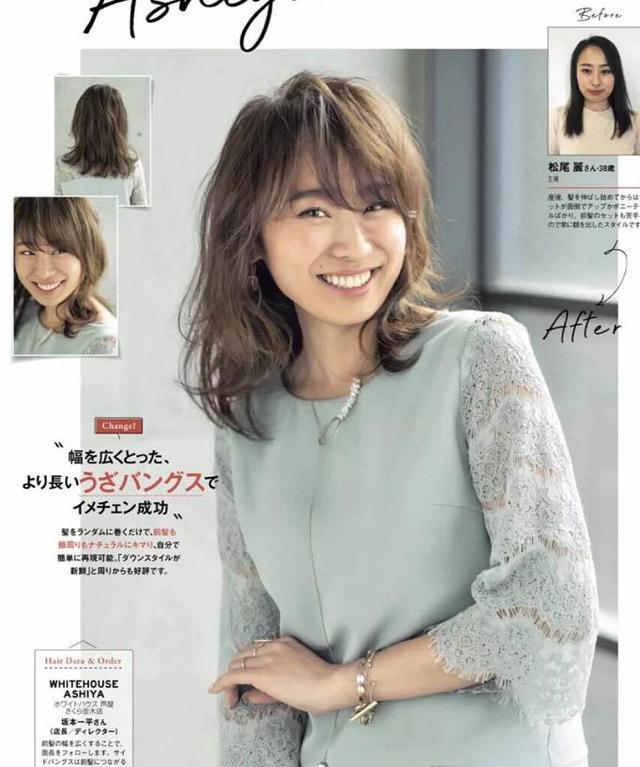 胃穿孔症状有哪些 胃穿孔的四大症状 胃穿孔症状有哪些 胃穿孔的四大症状