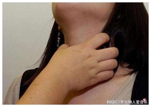 夜盲症吃什么 这四种食物帮你缓解 夜盲症吃什么 这四种食物帮你缓解