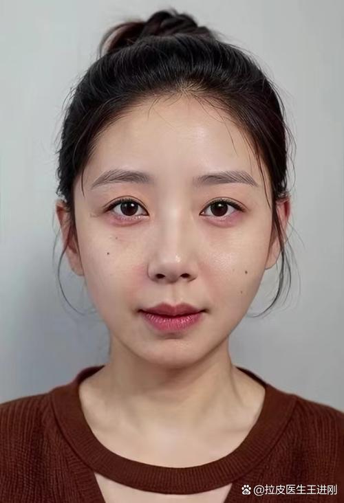 心源性猝死是怎么回事 心源性猝死是怎么回事