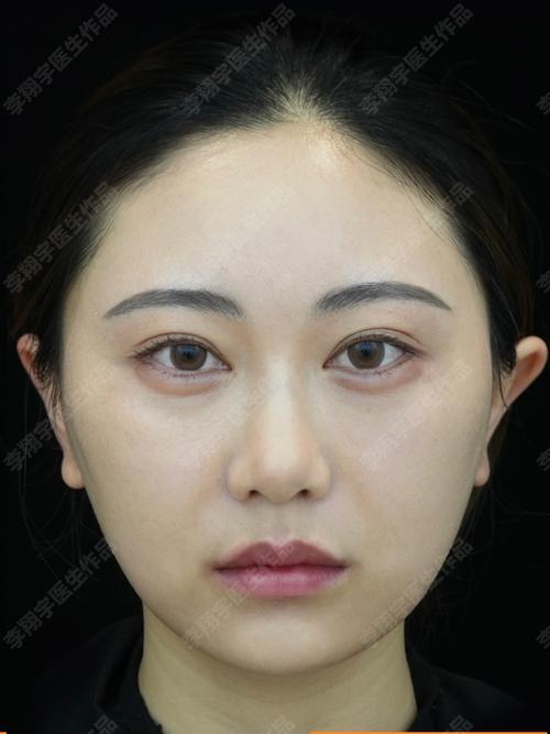 沙苑子和杜仲泡水喝的功效与作用 沙苑子和杜仲泡水喝的5个功效 沙苑子和杜仲泡水喝的功效与作用 沙苑子和杜仲泡水喝的5个功效