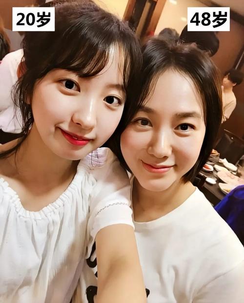 脱发主要症状有哪些 6大症状最明显突出 脱发主要症状有哪些 6大症状最明显突出