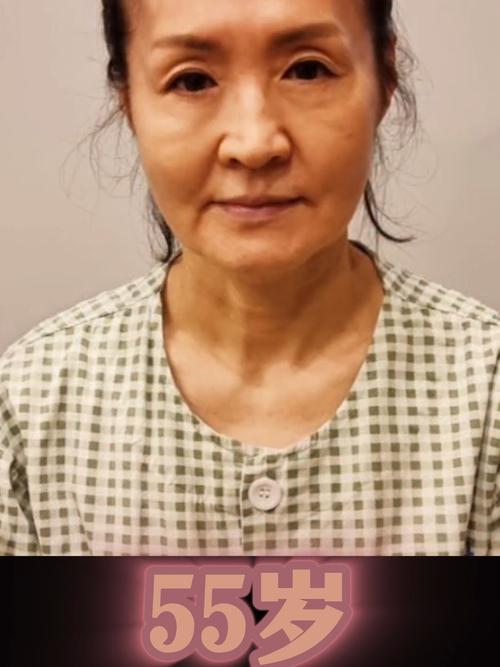 胃食道逆流是什么症状 胃食道逆流是什么症状