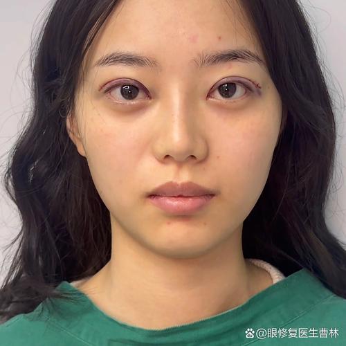 诺特兰德鱼油有什么功效和作用 诺特兰德鱼油的三大功效 诺特兰德鱼油有什么功效和作用 诺特兰德鱼油的三大功效