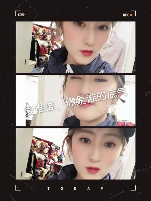 甲亢是什么原因引起的 甲亢是什么原因引起的