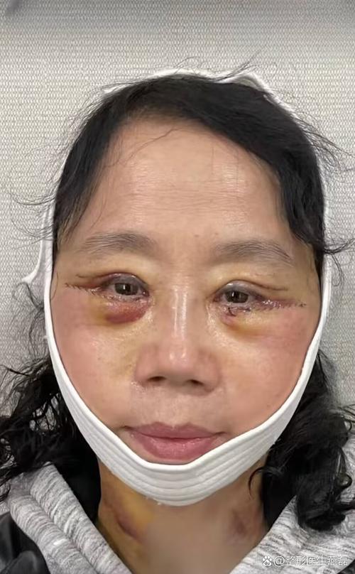 ��Ұ������ʳƪ_��Ұ������ʳƪ��ʲô����