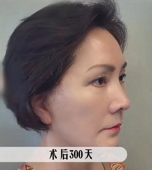 如何预防癌症? 如何预防癌症?