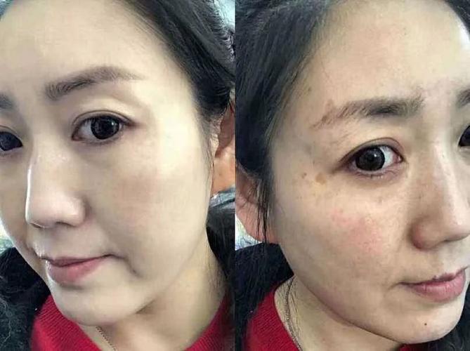 拾时喷剂引起前列腺异常是真的吗 拾时喷剂有副作用吗 拾时喷剂引起前列腺异常是真的吗 拾时喷剂有副作用吗