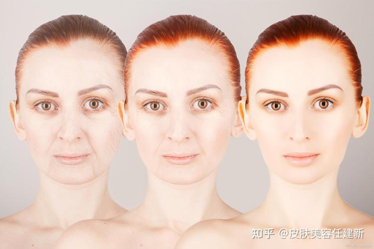 Ҫ�뽵�ǿ� ����Ч����