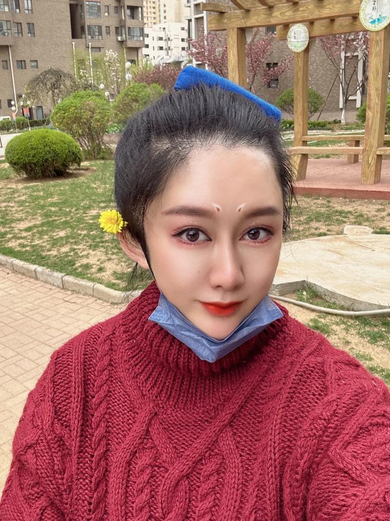 内分泌平衡后汗毛消失吗? 内分泌平衡后汗毛消失吗?