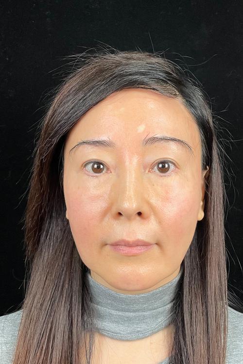 磨牙后牙齿酸痛怎么办 查找病因解决问题 磨牙后牙齿酸痛怎么办 查找病因解决问题