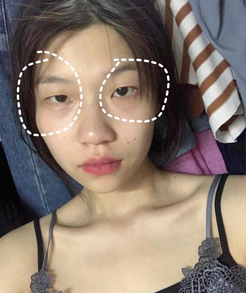 日本腾素是什么药 日本腾素效果怎么样 日本腾素是什么药 日本腾素效果怎么样