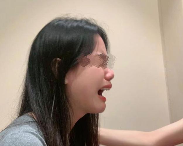 脸上长斑是因为什么原因引起的 脸上长斑是因为什么原因引起的