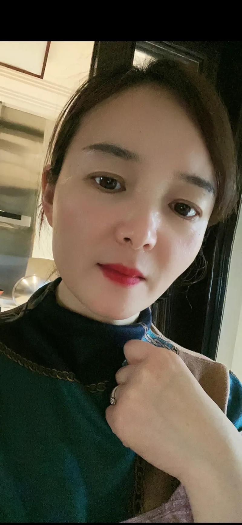 神经性皮炎怎么回事 神经性皮炎怎么回事