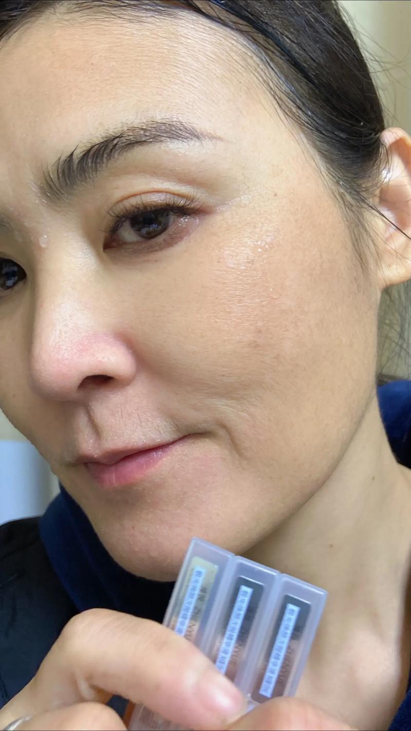 激素脸排毒的6个过程 激素脸的正确养护法 激素脸排毒的6个过程 激素脸的正确养护法