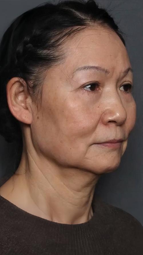 �Բ�ɸ�������ô����