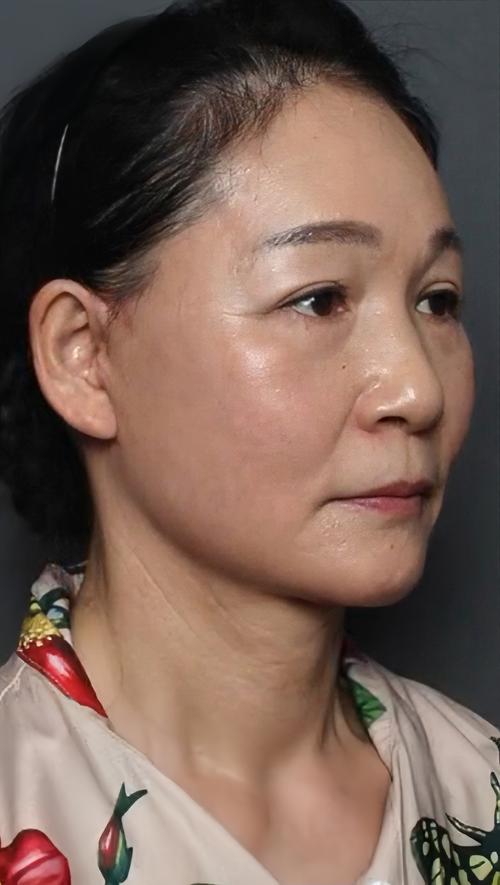 无痛人流对身体的伤害 无痛人流对身体的伤害