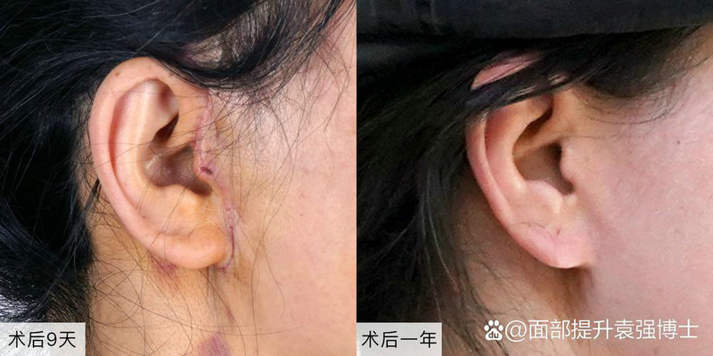 ��������ʵ�����ж��