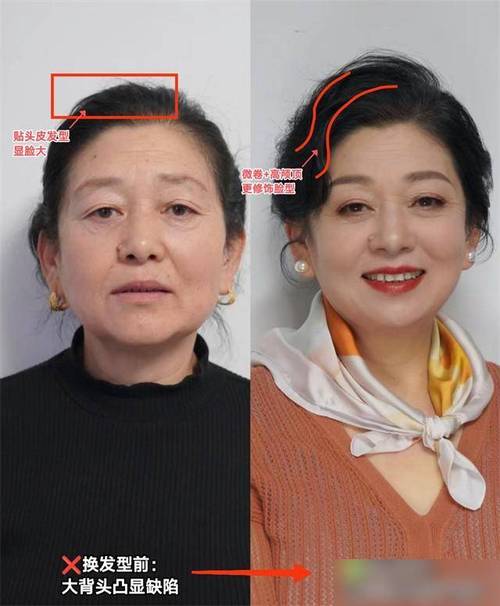 宫颈糜烂是什么病,有什么症状 宫颈糜烂是什么病,有什么症状