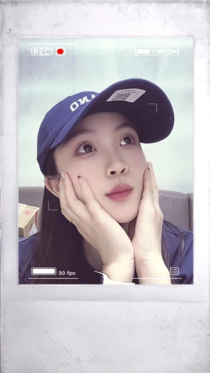 自体脂肪填充的缺点 不像你想象中的安全 自体脂肪填充的缺点 不像你想象中的安全