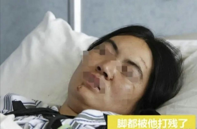 ͶʪԹؽס׵Թؽס֧򲡵