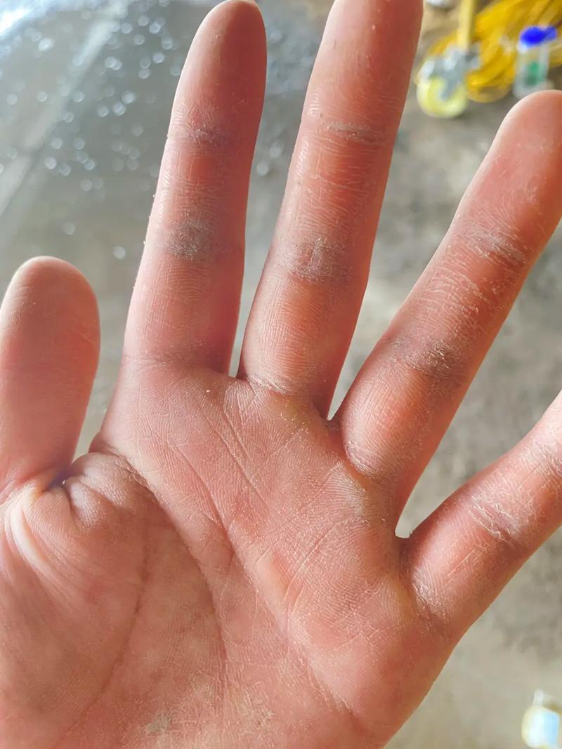 高血糖偏方秘方大全 治疗高血糖的秘方 高血糖偏方秘方大全 治疗高血糖的秘方