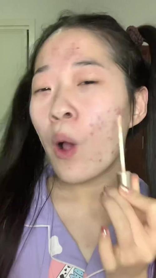 手指脱皮开裂硬化是什么原因 手指脱皮开裂硬化是什么原因